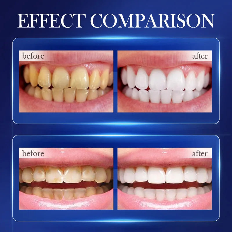 Baking Soda Probiotic Whitening Toothpaste