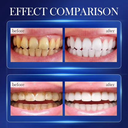 Baking Soda Probiotic Whitening Toothpaste